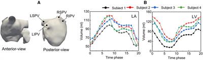 Do blood flow patterns in the left atriums differ between left upper lobectomy and other lobectomies? A computational study